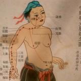 Bioacupuncture